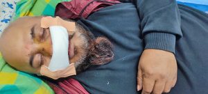 रुपन्देही कांग्रेसको मत गणनास्थलमा झडप, उम्मेद्वारसहित पाँच जना घाइते