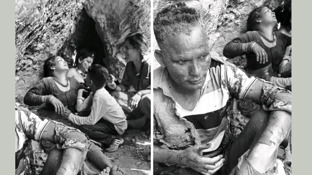 दैलेखमा डढेलोले जलेर १२ मजदुर घाइते